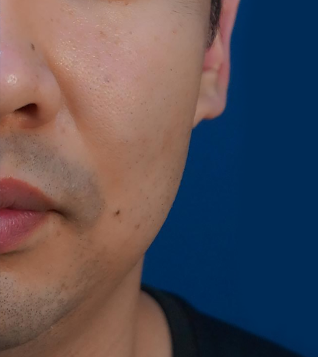 Porzellan Skin Glazer | Before